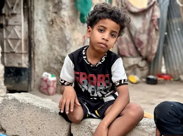 أطفال اليمن.. قضية تاريخية تتجدد رغم مرور 75 عاماً