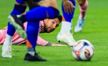 إصابة جديدة لميسي تعقد حسابات كأس العالم المقبلة