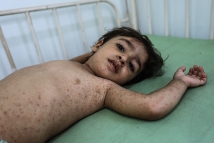 غزة تحت وطأة الحرب 64 ألف طفل يتيم