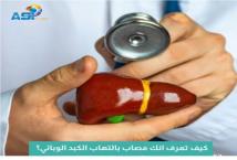 فيديو: كيف تعرف انك مصاب بالتهاب الكبد الوبائي؟(1د 24ث)