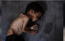 أطفال غزة يموتون جوعًا.. والعالم يتفرج