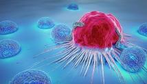 3 أنواع من مرض السرطان تتطور من دون عوارض